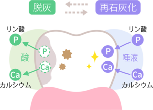 歯の再石灰化